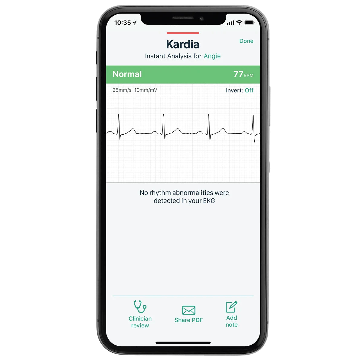 KardiaMobile Personal ECG with Carry Pod